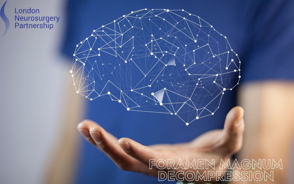 foramen magnum decompression
