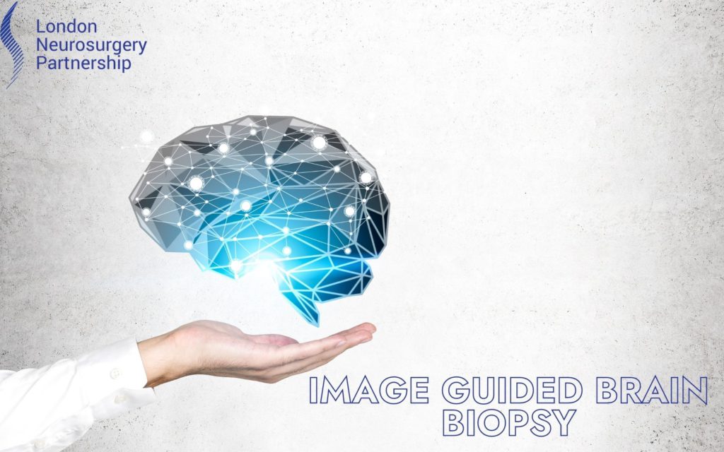 image guided brain biopsy