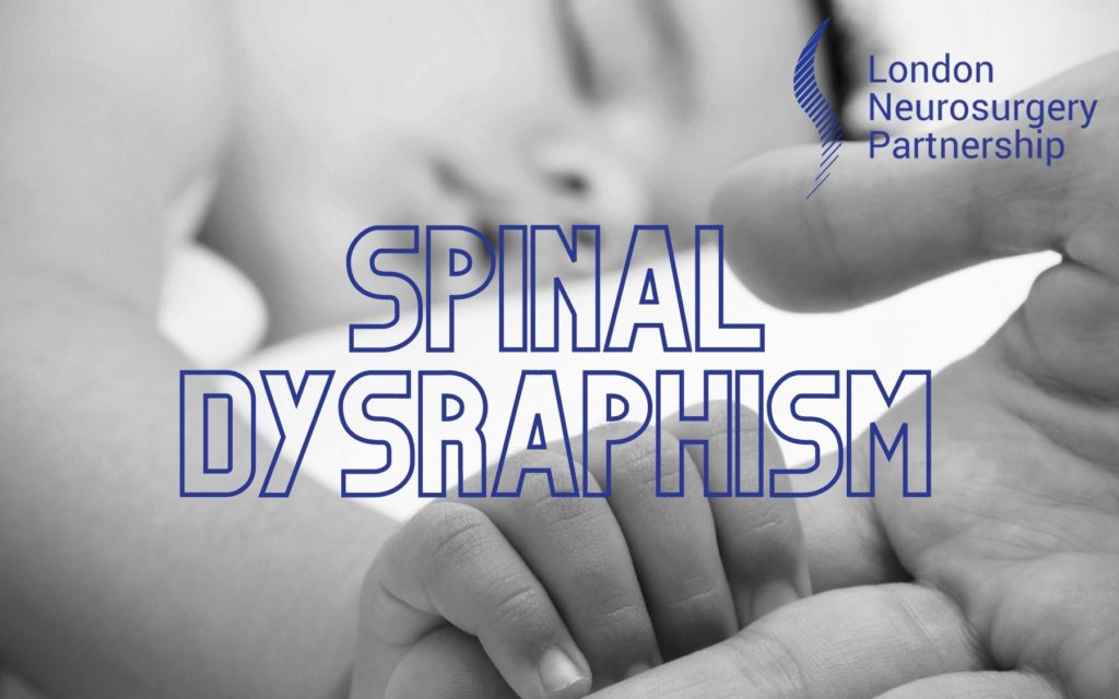 spinal dysraphism LNP
