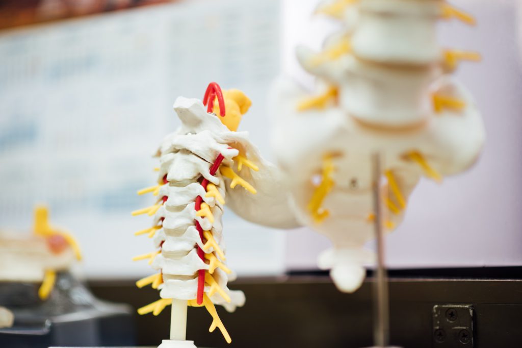 Spinal Cord Stimulation for Back Pain